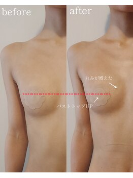 ブルーム(bluem)/オールハンドバストケア