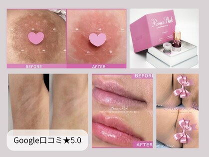 アンジェロ(Angelo)の写真