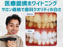 スマイルホワイト 赤羽店