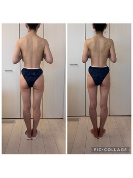 ハートエルボー(Heart elbow)/二人三脚