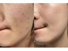 ユミサロン(U Mi Salon)/