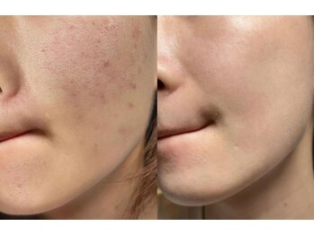 ユミサロン(U Mi Salon)/