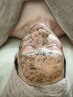 実績多数★シミケアハーブピーリングで透明肌へ剥離なしの実感ケア