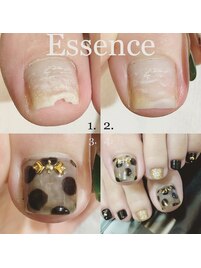 爪トラブルもお直しいたします♪