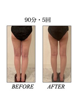 ファミーユ 新宿店/【インディバ &nbsp;術後ケア】