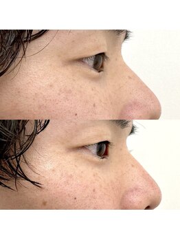 ササ アイブロウ バイ フォルス 梅田店(33 eyebrow by fors)/メンズまつげパーマ