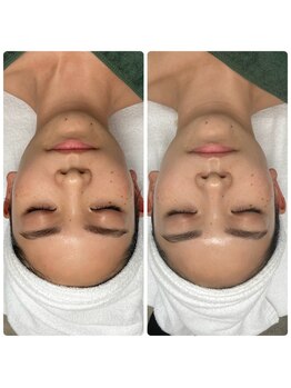 ジェニー(JENNI)/VVSダイヤモンドピーリング