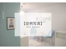 ベル 熊本店(Belle)/お客様のBefore｜After