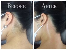 リボーン(REBORN)/顔脱毛もご用意◎