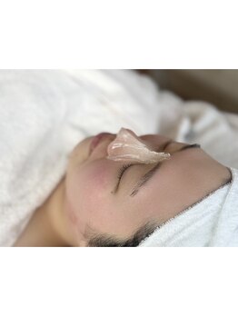 顔脱毛がしたい