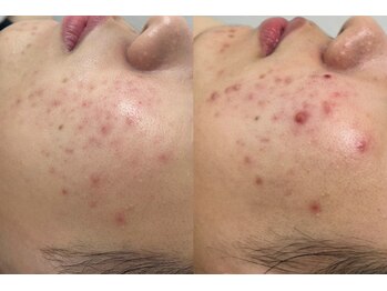 アンリミット 下北沢店(Une limit)/[お悩みの方お任せください】