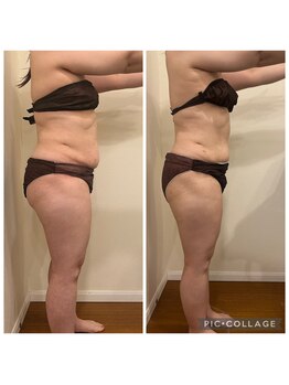 ギンザエクランの写真/サイズダウンで自信UP！美脚・くびれを目指し、理想のボディラインへ導くエステ体験◎