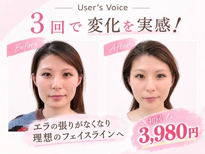 小顔美肌ファクトリー 金沢院の写真