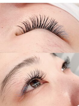 ベルグレン(Belleglen)/