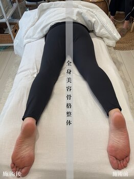 アール アンド ビューティーサロン(Ｒ＆ BeautySalon)/全身美容骨格整体