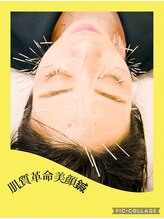 サクラプラス(SAKURA Plus)/肌質革命美顔鍼50本