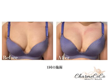 シャルムココ 蔵前店(CharmeCoCo)/お客様Before→After