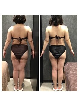 フローボディ 新山口店(flow BODY)/山口のエステはflow BODY