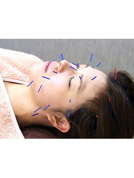 小顔になりたい