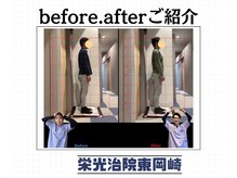 栄光治院 整体院東岡崎/たったの１０分でこの変化！？
