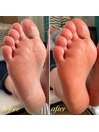 フット角質ごっそりオフ