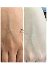 サナ 久が原 千鳥町(S’ana)/ハーブピーリング