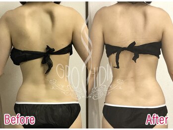 グラウディア 恵比寿/痩身/不調歪み改善/筋膜リリース