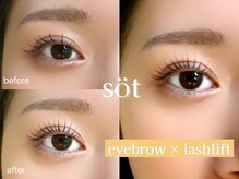 ソート(sot)/セットメニューで垢抜け顔に♪