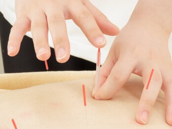 久が原駅前通り整骨院/鍼灸