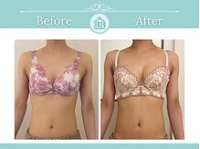 美人バスト 新潟店/ 【バストアップ★育乳】症例