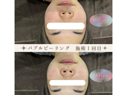 ラメール 神栖VENUS店(La mer)の写真