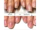 ビビネイル(BIBI Nail)の写真/【美爪育成サロンの本格爪育プランが大人気!!】教育関係・飲食系・お爪にコンプレックスをお持ちの方必見☆