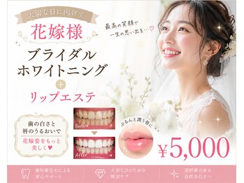 ココホワイトニング(coco whitening)の写真/歯科衛生士がサポートする安心ホワイトニング。丁寧なカウンセリングで初めての方も安心。

