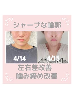 ビューティスタジオＫ/小顔矯正でシャープな輪郭