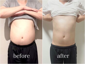 サンク(Cinq)/【猫背整体+腸もみ】ダイエット