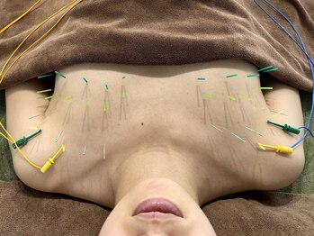 フラット(flat)/鍼でバストケア★姿勢・巻き肩も