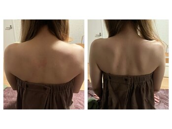 サロン シャンティー/一度の施術での変化