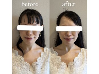 ミロク 伏見桃山店(miroku)/リリアンジェット