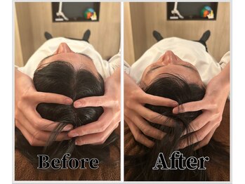 整体ラルース 中目黒(LALUZ)/20代 男性 小顔ヘッドスパ 変化