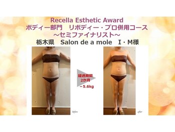 サロンドアモール(Salon de a mole)/【痩身】お悩みお背中とお腹周り