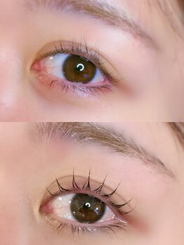 ラプレ(Lapule)/ビフォーアフター!