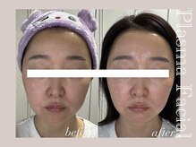 ミリュール(Millule)/あらゆるお肌悩みに