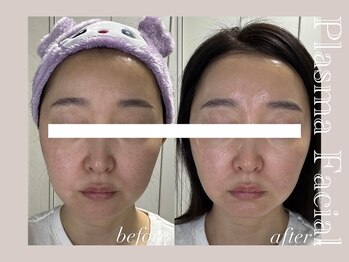 ミリュール(Millule)/あらゆるお肌悩みに