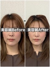 ハリサロンドオフ 堺東店(hari salon de off)/お客様before→after