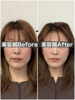 ハリサロンドオフ 堺東店(hari salon de off)/お客様before→after