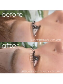 ビューティーグロウ(BEAUTY-GROW)/