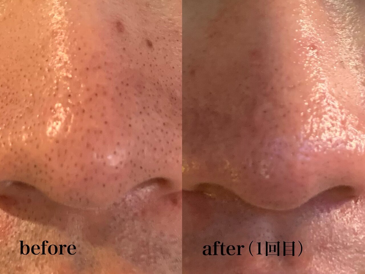 肌質改善エステサロン♡ シゼン 恵比寿店(S1ZEN+)｜ホットペッパービューティー