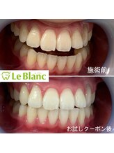 ルブラン 奈良店(Le Blanc)/効果あり！！