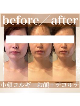 カモミール(chamomile)/BeforeAfter