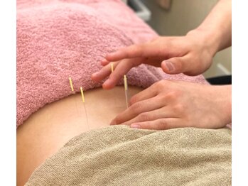 マイストレッチ 桜木町店(My Stretch)/【施術：鍼施術】